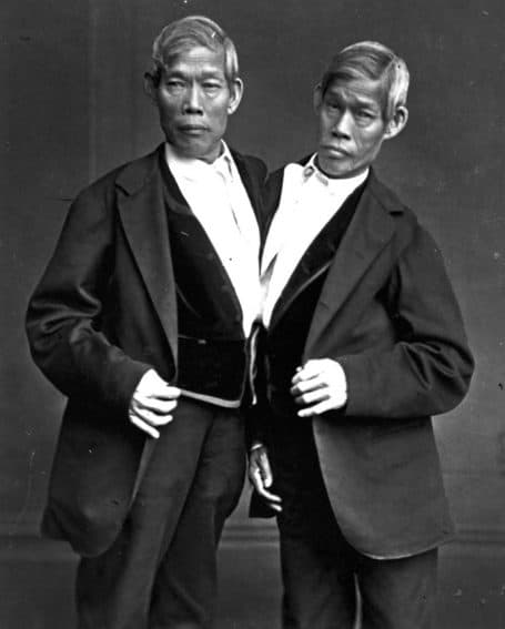 Chang and Eng Bunker were the original ‘Siamese Twins.’